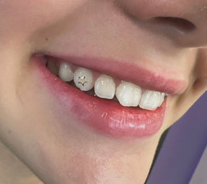 JENNXINK TOOTH GEMS ONLINE